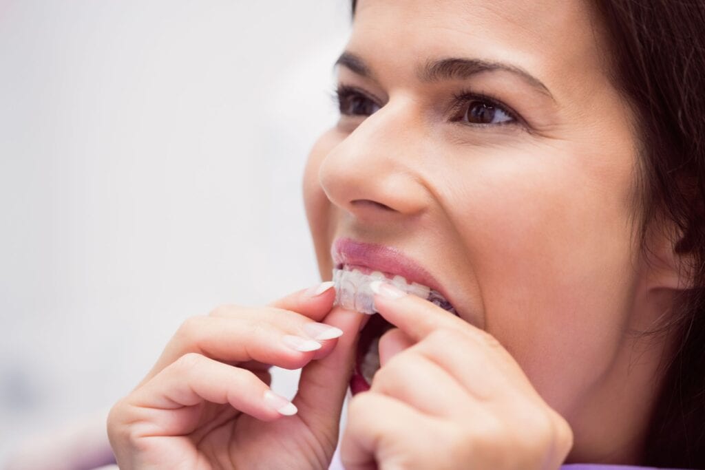 Invisalign Provider in Coconut Creek, FL